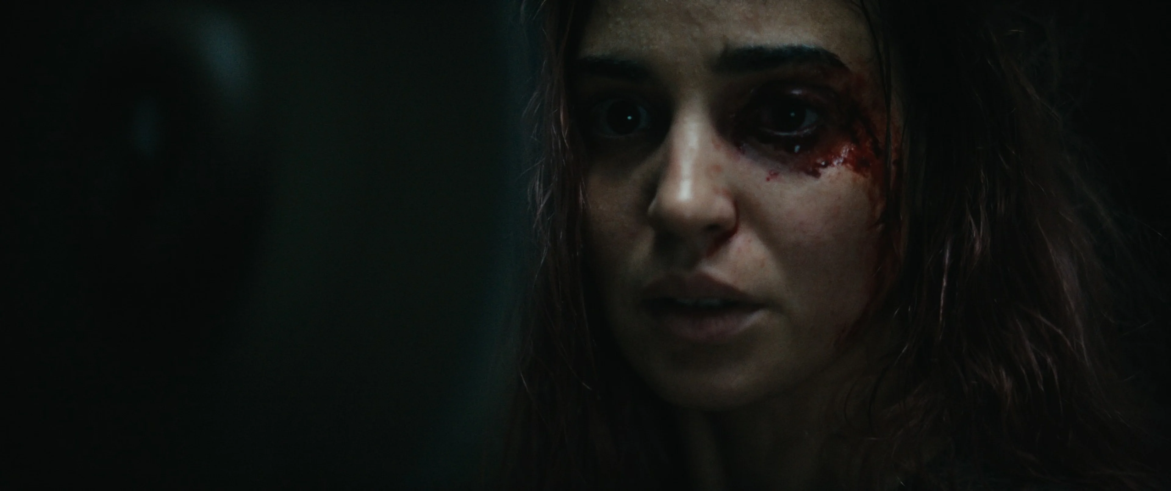 Souheila Yacoub as Alice, with an injury beside her eye.