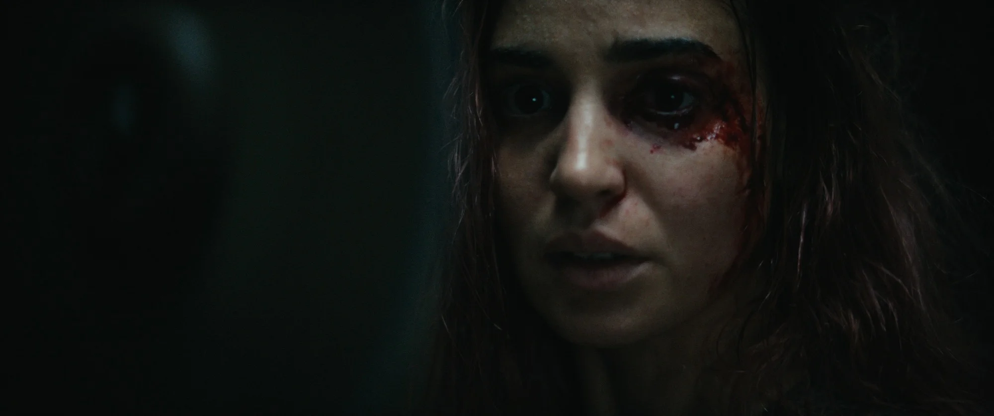 Souheila Yacoub as Alice, with an injury beside her eye.